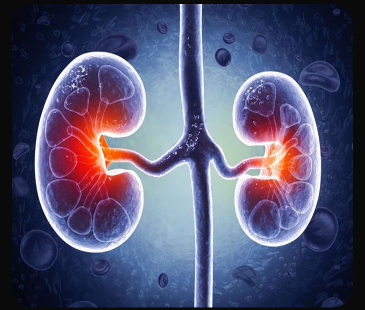 Causes of prevalent kidney failures and solutions