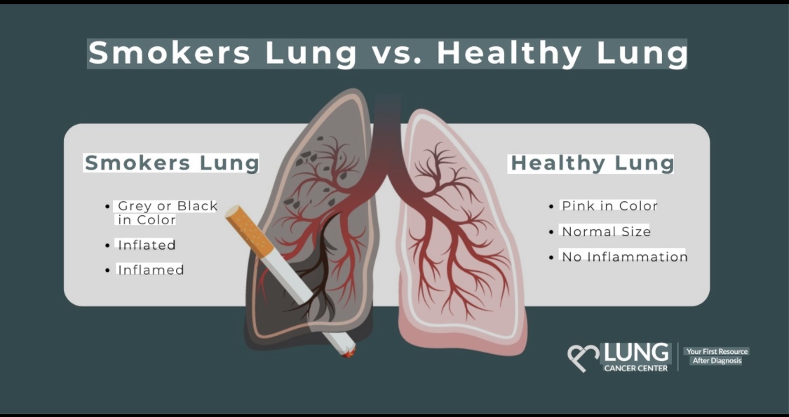 Reasons why cigarettes is bad